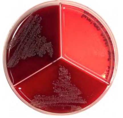 Staphylococcus aureus displaying hemolysis on Factor agar.