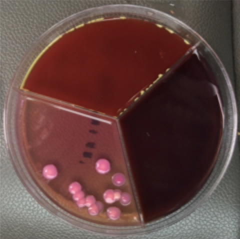 Figure 5 Gram-negative bacteria growth
