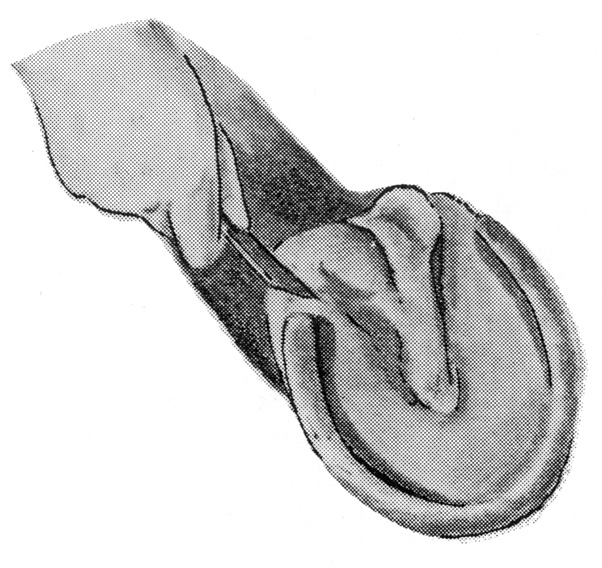 Diagram of the bottom of a horse's hoof and a person's hand holding a cleaning tool.