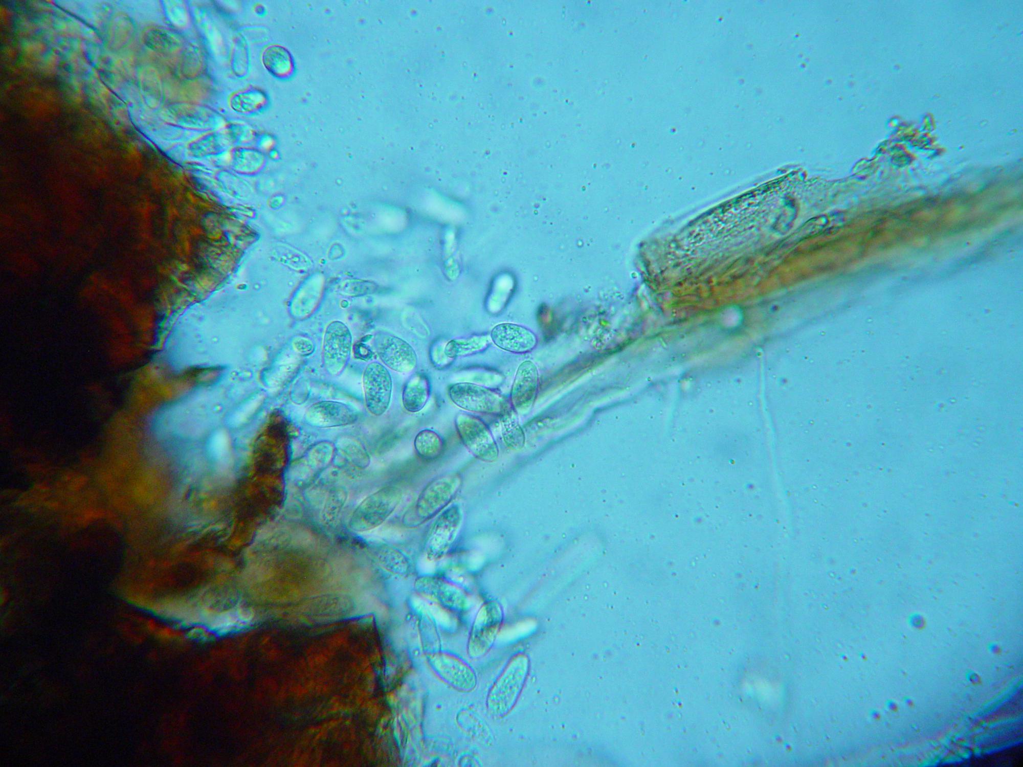 Spores of the Macrophomina phaseolina pathogen can be seen as transparent ovals in this microscopic image taken from an infected SunPatiens plant. (Photo by MSU Extension Service/ Clarissa Balbalian)