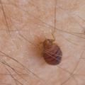 Close-up of a tiny brown insect on human skin.