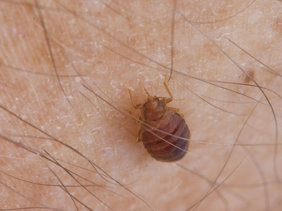 Close-up of a tiny brown insect on human skin.