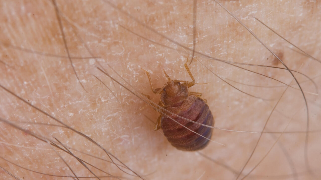 Close-up of a tiny brown insect on human skin.