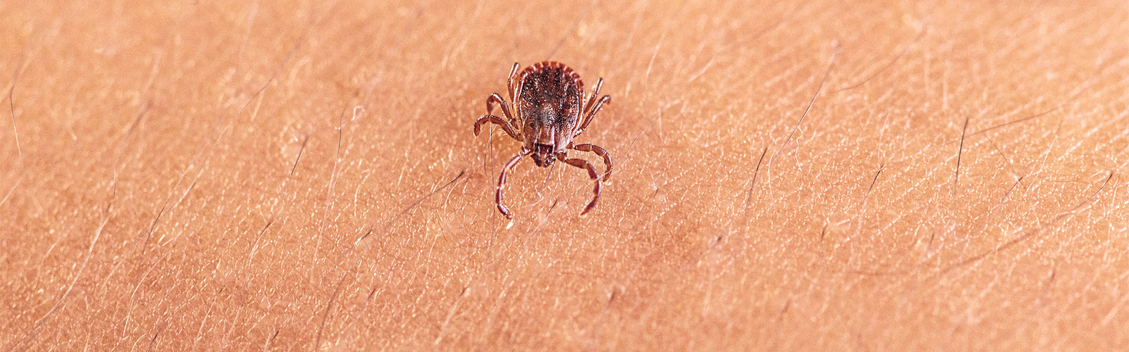 An adult female Asian longhorned tick, Haemaphysalis longicornis, crawling on a person’s skin.