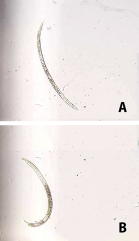 Root-knot nematode under magnification is long, slender, and slightly curved. Reniform nematode under magnification is very similar but more curved.