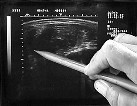 A hand is using a pencil to point to a scanned image of the ribeye area.